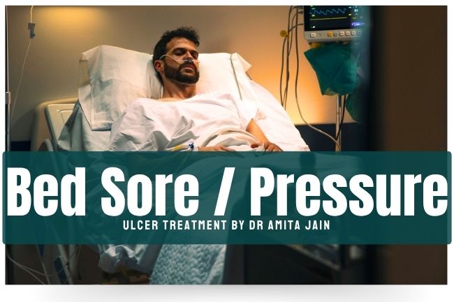 best bed sores treatment in Delhi by Dr Amita Jain